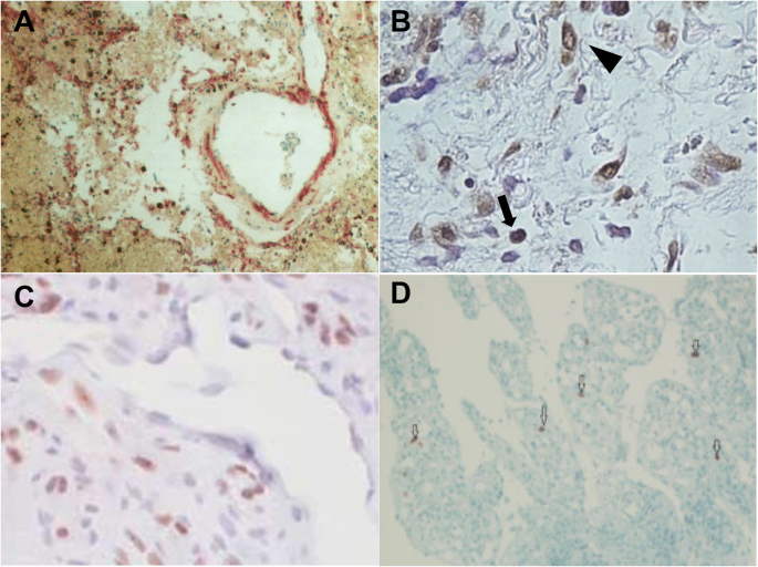 IHC Study Design